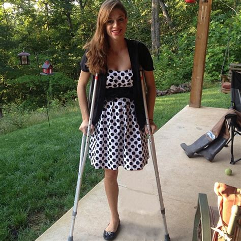 amputee woman on crutches|woman leg amputee crutches.